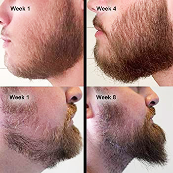 Beard Growth Serum